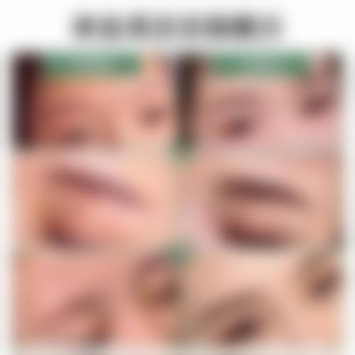 四、北京466医院整形美容科特色项目