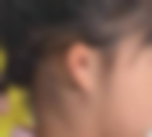 二、武汉铂晟整形医院怎么样？