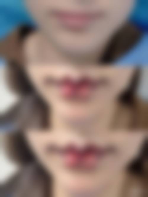 三、深圳常安润禾整形医院诊疗项目有哪些？