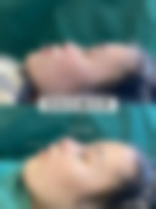 四、韩国PHD皮肤科特色项目