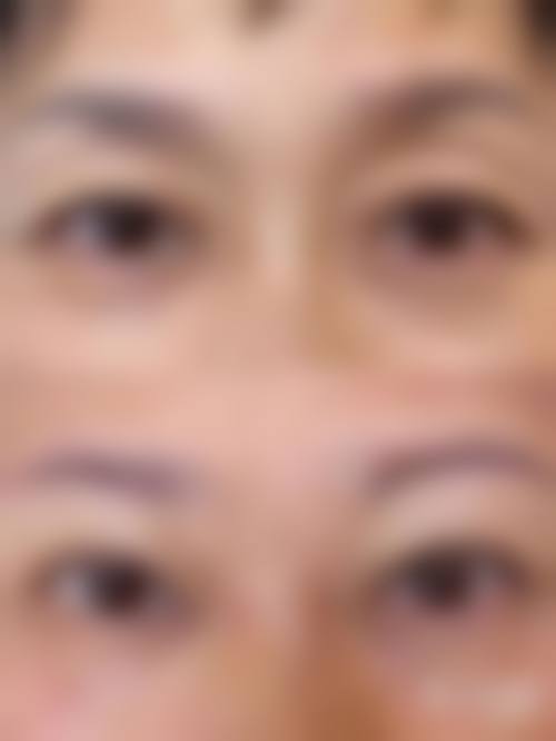 八、武汉铂晟整形医院真实的患者评价