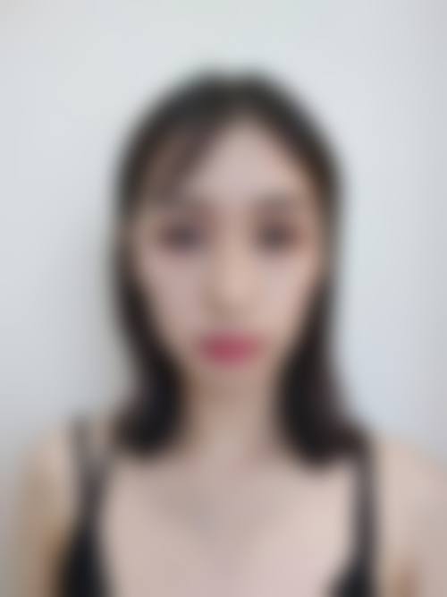 四、贵州医 科 大学第二附属医院(美容科)特色项目