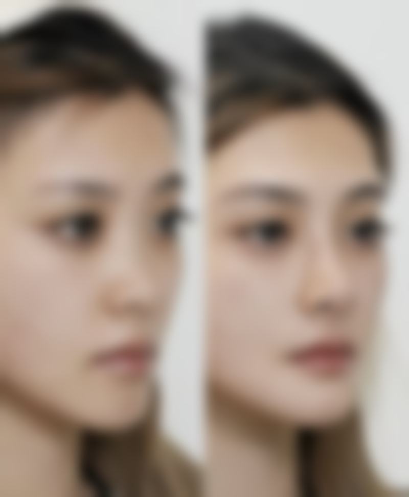 七、十堰楚美熙整形医院预约方式