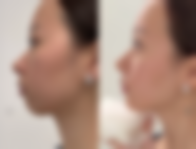 七、乐清艳后医疗美容诊所预约方式