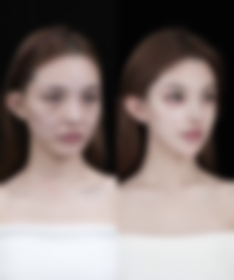 二、绿毒瘦脸针的成效展现