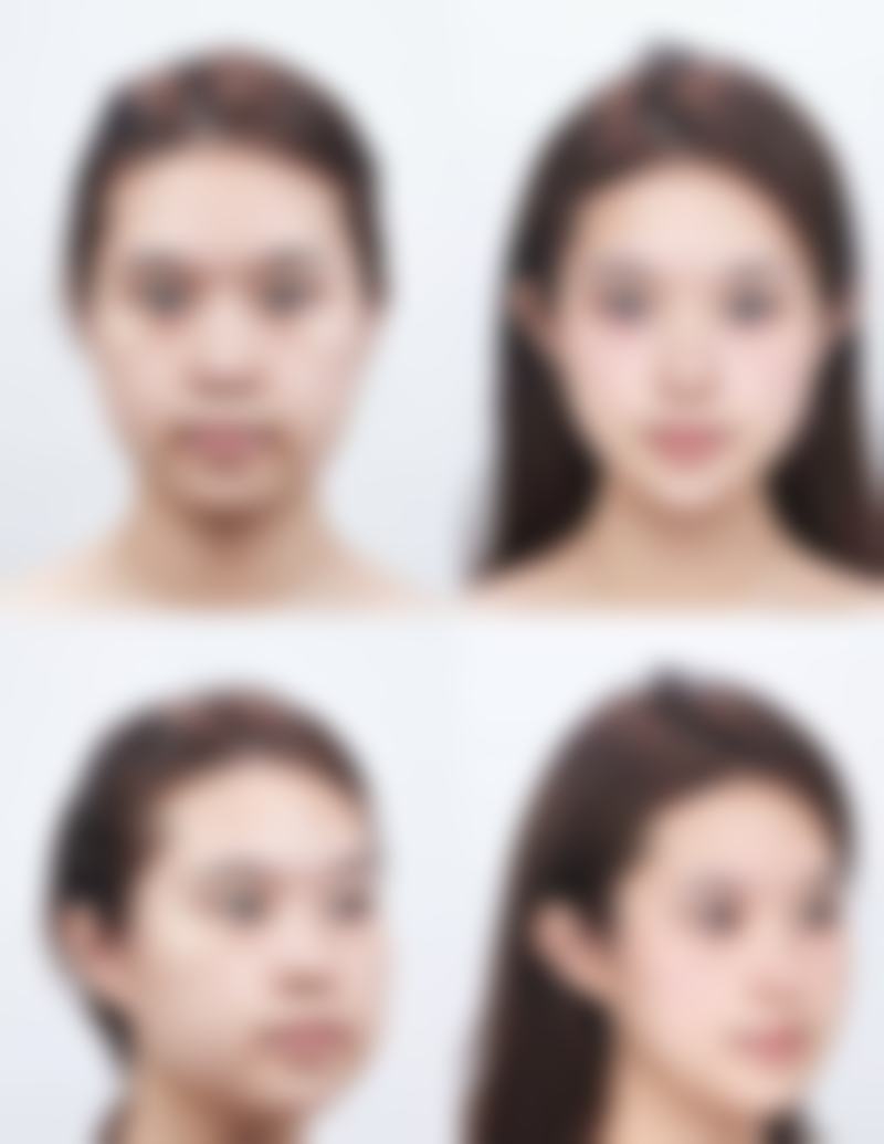 一、割完双眼皮生理盐水使用时长的总体情况