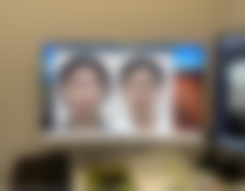 四、瘦脸针成效维持与后续护理