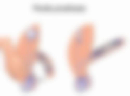 一、增生性疤痕看什么科