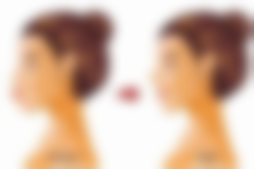 四、术后注意事项