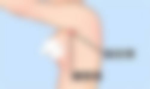 六、日常护理要点