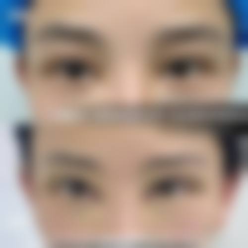 四、福州协和医院整形科特色项目