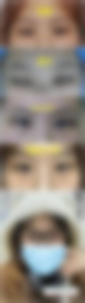 八、深圳格美整形医院真实的患者评价