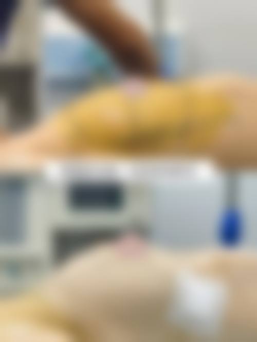 三、福州协和医院整形科诊疗项目有哪些？