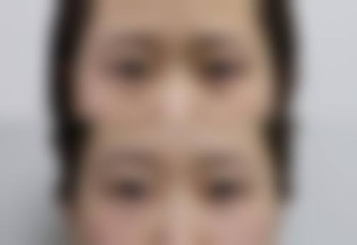 四、成都蜜拉贝儿医疗美容门诊部特色项目