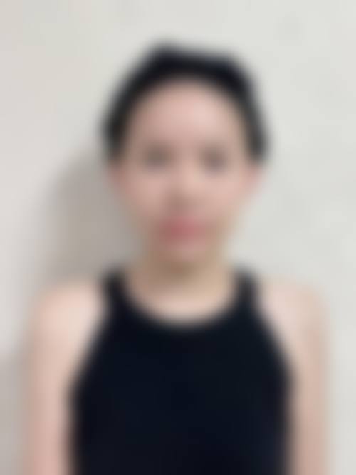 九、呼和浩特蕊儿医疗美容诊所真实的患者评价