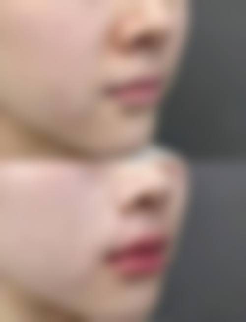 八、内蒙古呼和浩特青春美整形医院预约方式