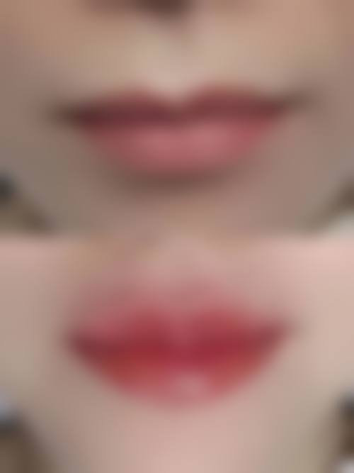 五、河源美斯嘉医疗美容价格表