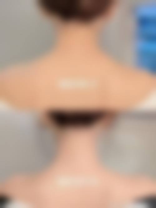 二、南宁熠美整形怎么样？