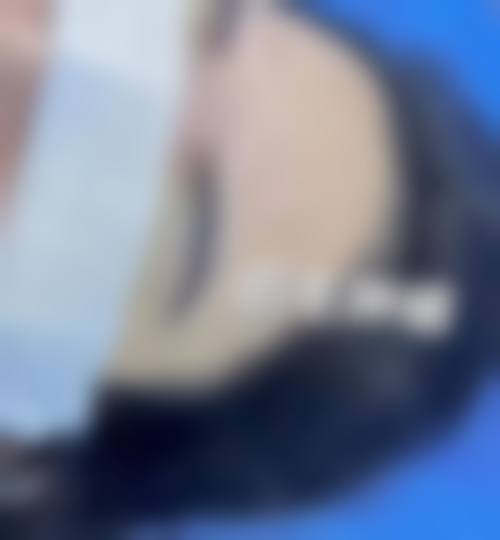 九、义乌柠栎整形美容门诊部真实的患者评价