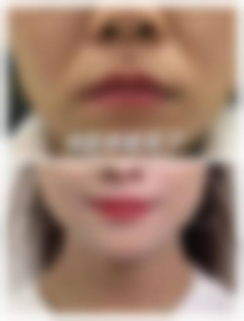 七、沈阳爱壹整形医院预约方式