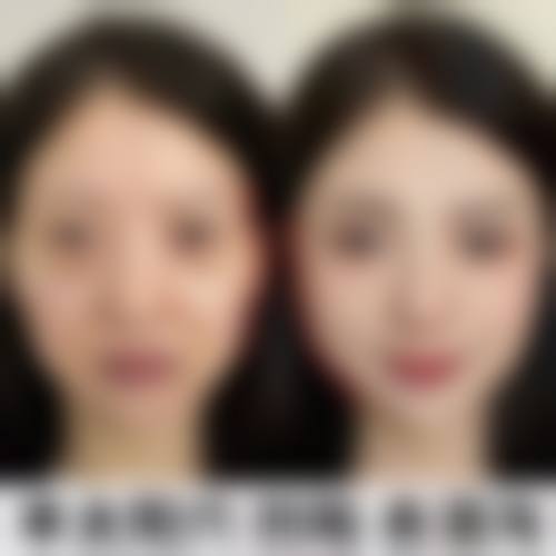 八、杭州秀华医疗美容诊所真实的患者评价