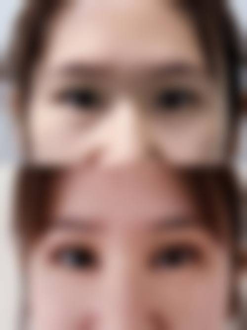 二、深圳格美整形医院怎么样？