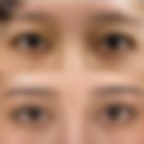 八、郑州市美遇医疗美容门诊部真实的患者评价