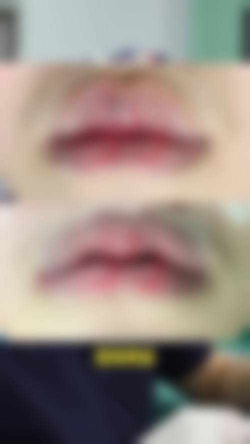 八、青岛市城阳区人民医院整形美容科预约方式