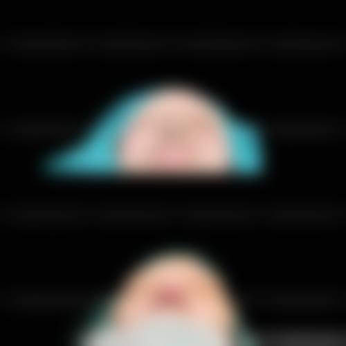 四、郑州市美遇医疗美容门诊部特色项目