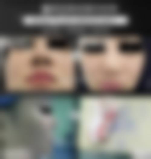 八、贵州省人民医院预约方式