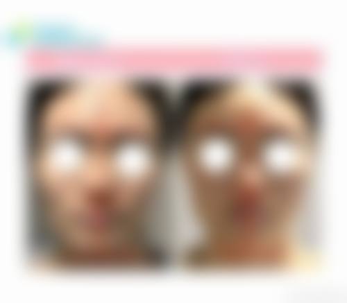 四、沈阳爱壹整形医院特色项目