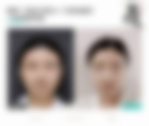 四、太原嘿象整形医院特色项目