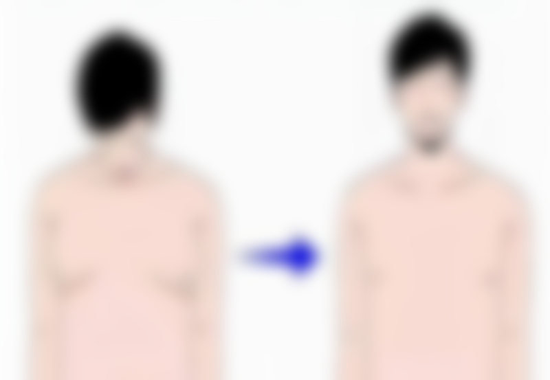 增生性疤痕看什么科最好？皮肤科、整形外科等科室为你提供专业方案！ 