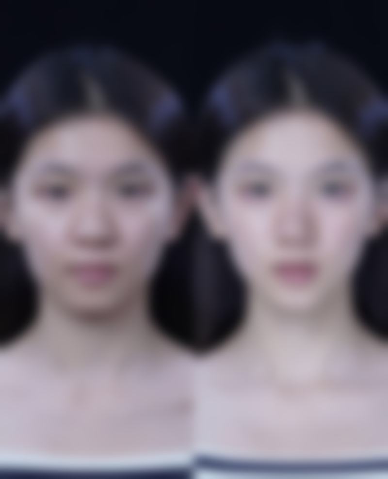 九、青岛市城阳区人民医院整形美容科真实的患者评价