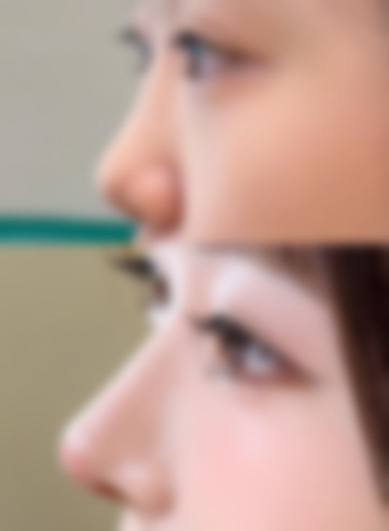 五、雷曼苹怎么预约?