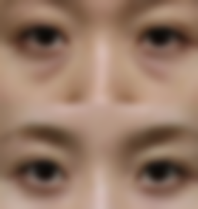 二、青岛市城阳区人民医院整形美容科怎么样?