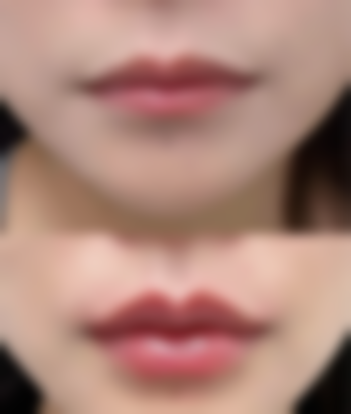 四、青岛市城阳区人民医院整形美容科特色项目