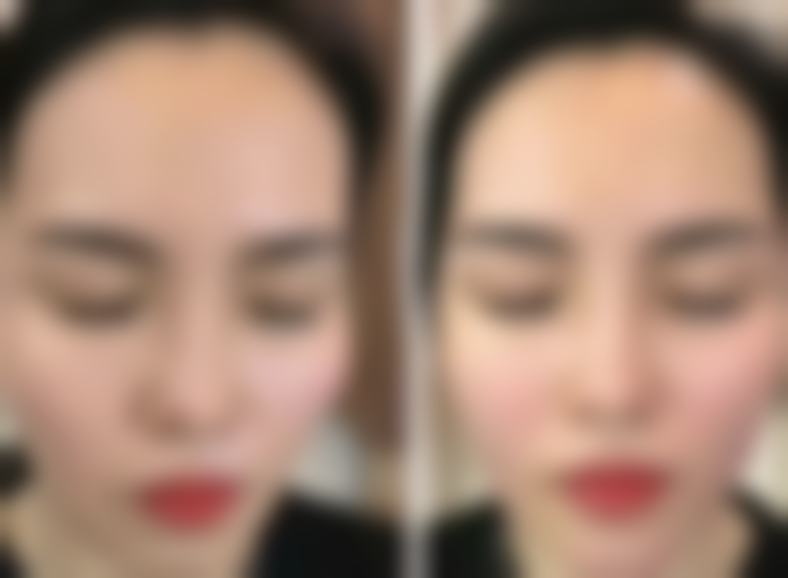 四、伊藤康平收费价格表