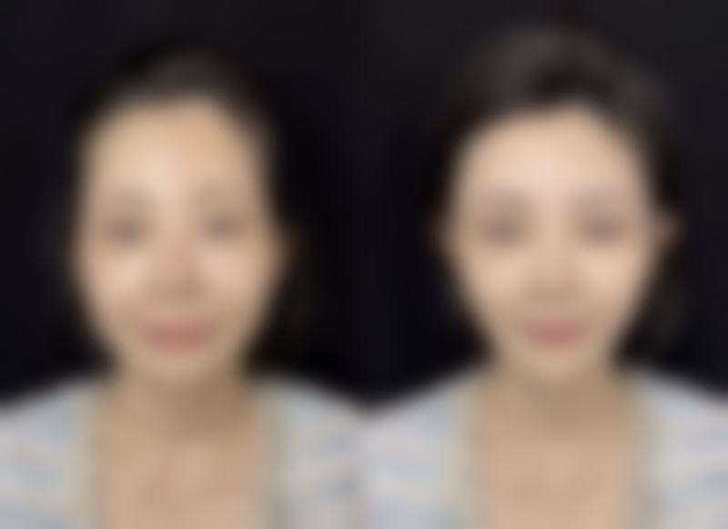 三、特殊情况的处理