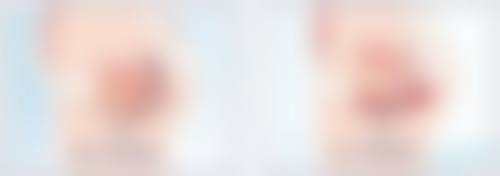 二、常见治疗方法及适用情况