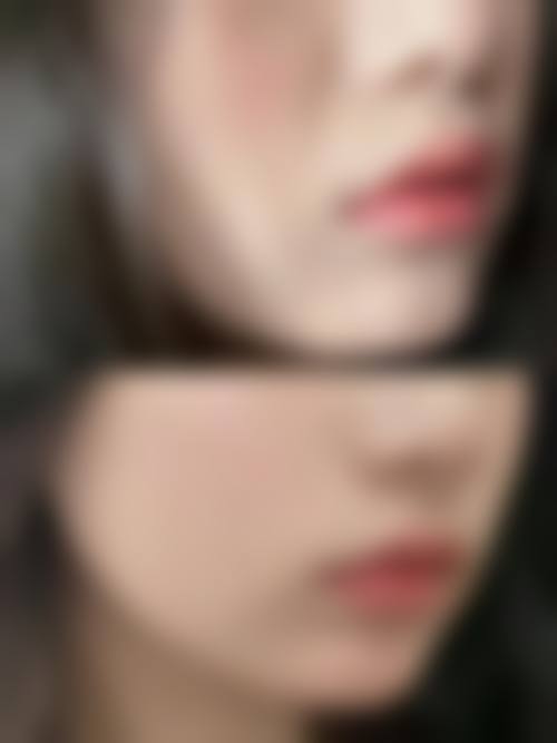 二、雪纖瘦医疗美容怎么样?