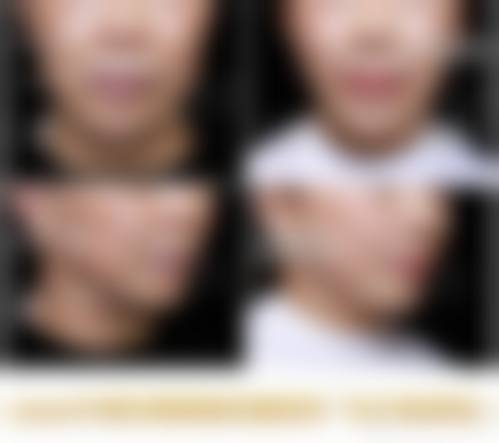 三、雪纖瘦医疗美容诊疗项目有哪些?