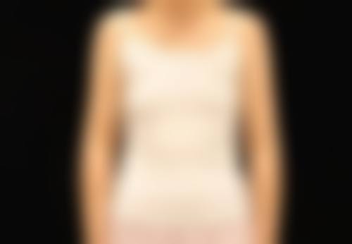 五、菏泽雅致医疗美容诊所价格表