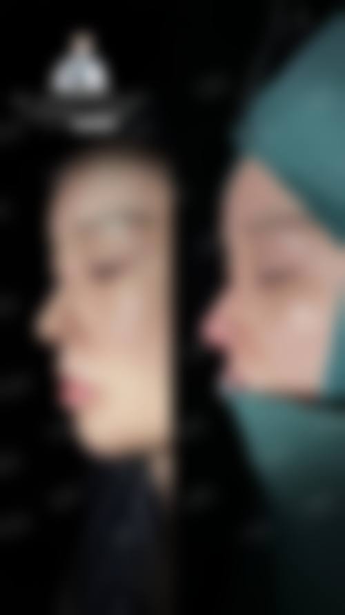 八、龙岩欧菲整形美容门诊部真实的患者评价