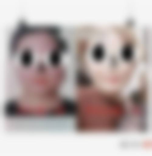 五、雪纖瘦医疗美容价格表