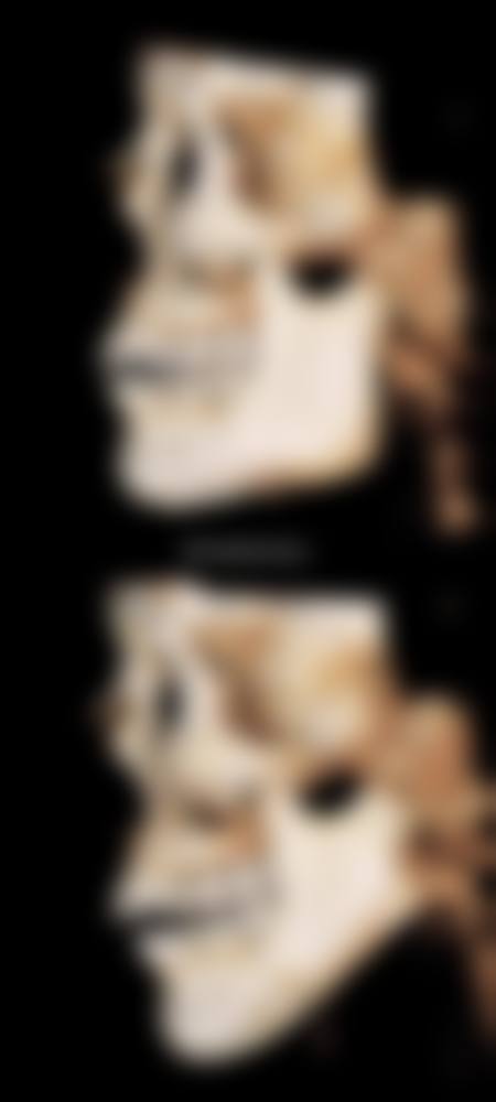 七、雪纖瘦医疗美容预约方式