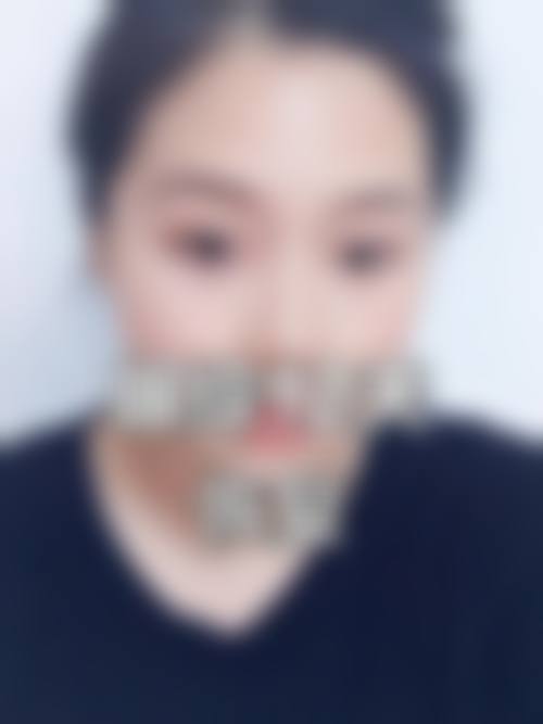 四、雪纖瘦医疗美容特色项目