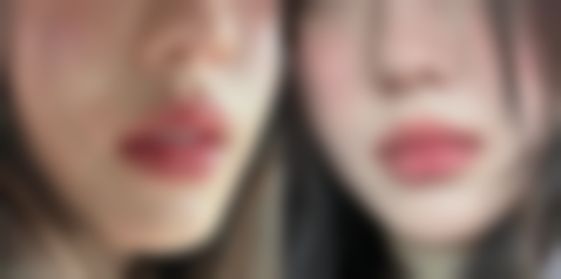 内双怎么变成双眼皮呢小窍门：非手术与手术方法全揭秘，附实用图片参考！ 