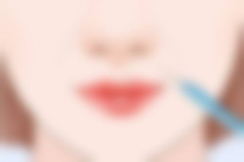 二、假体隆胸手术要点