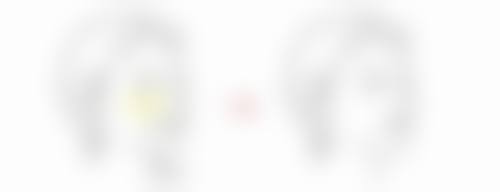 三、瘦脸针打半只有成效吗之适用情况分析